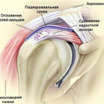 CHto-delat'-esli-boljat-plechi-Kompleks-uprazhnenij-Что-делать-если-болят-плечи-Комплекс-упражнений